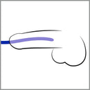 KIT DE 3 DILATADORES DE URETRA
