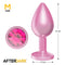 PLUG ANAL AFTERDARK ANODIZADO ROSA COM ROSA
